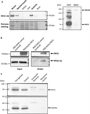 Hypercontractile cardiac phenotype in mice overexpressing the regulatory subunit PR72 of protein phosphatase 2A